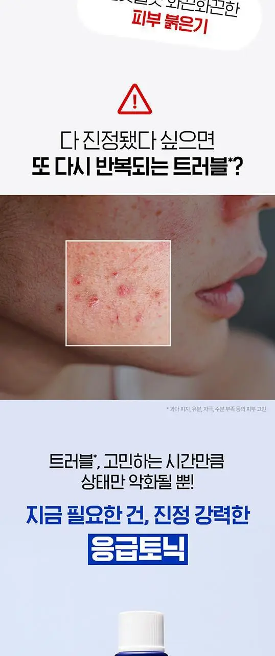 [응급진정토닉] 아이소이 아크니 닥터 1st 컨트롤 토닉 90ml 상세페이지 3